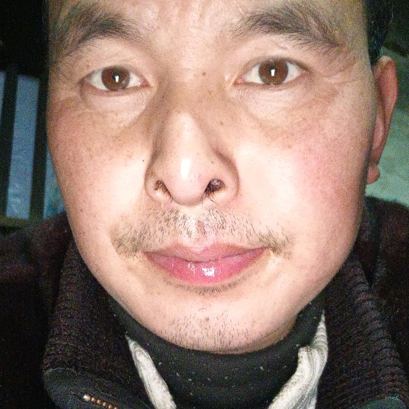 舒化平(不定时开)。