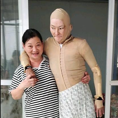 钱陈妈妈陈晓华（陪儿子康复）