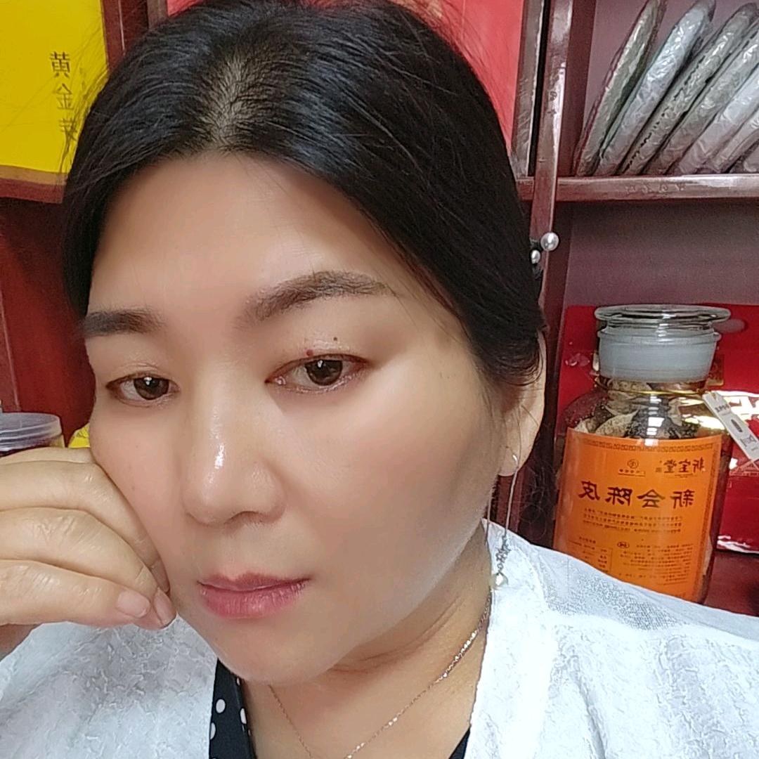 云南土特产（拒绝连赞，谢谢）