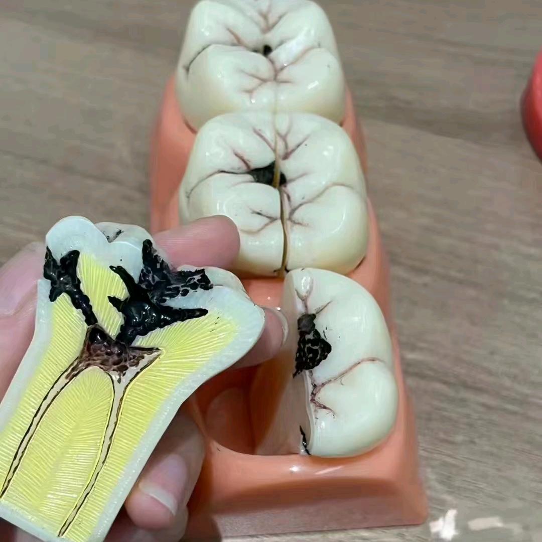 艾笑口腔护理