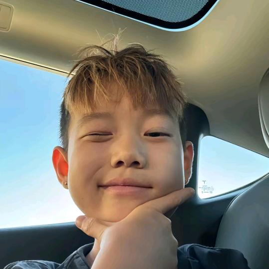 你的眼怎么红了