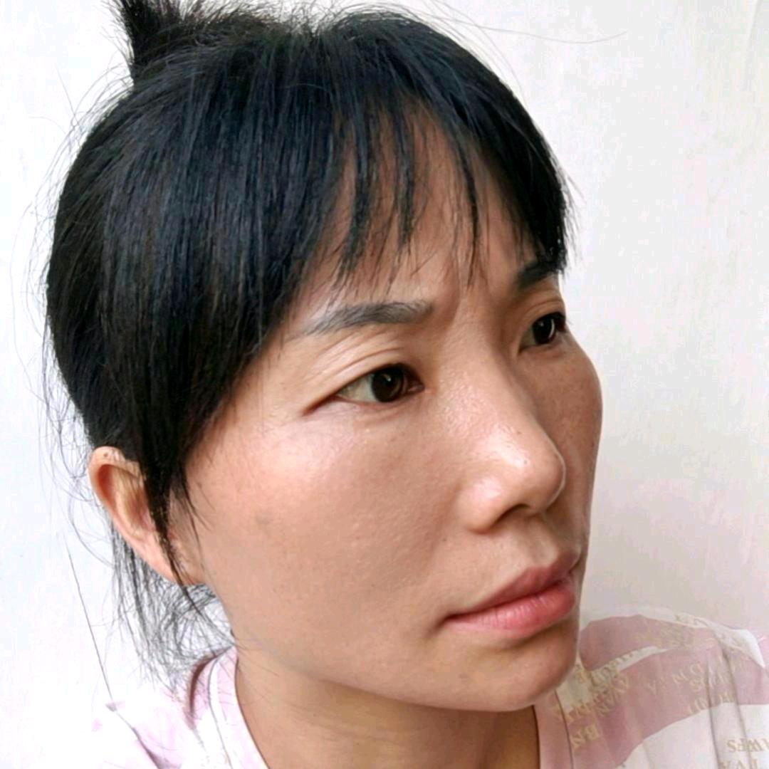 亚平