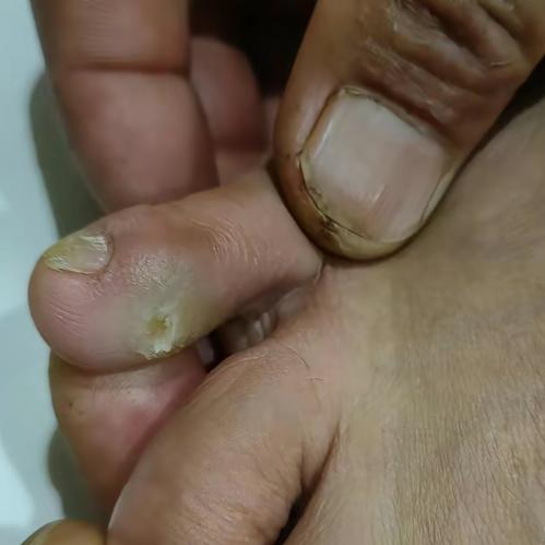 天下太平♥鸡眼哥