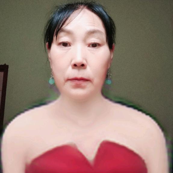 术英
