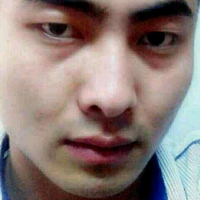 天使的吻