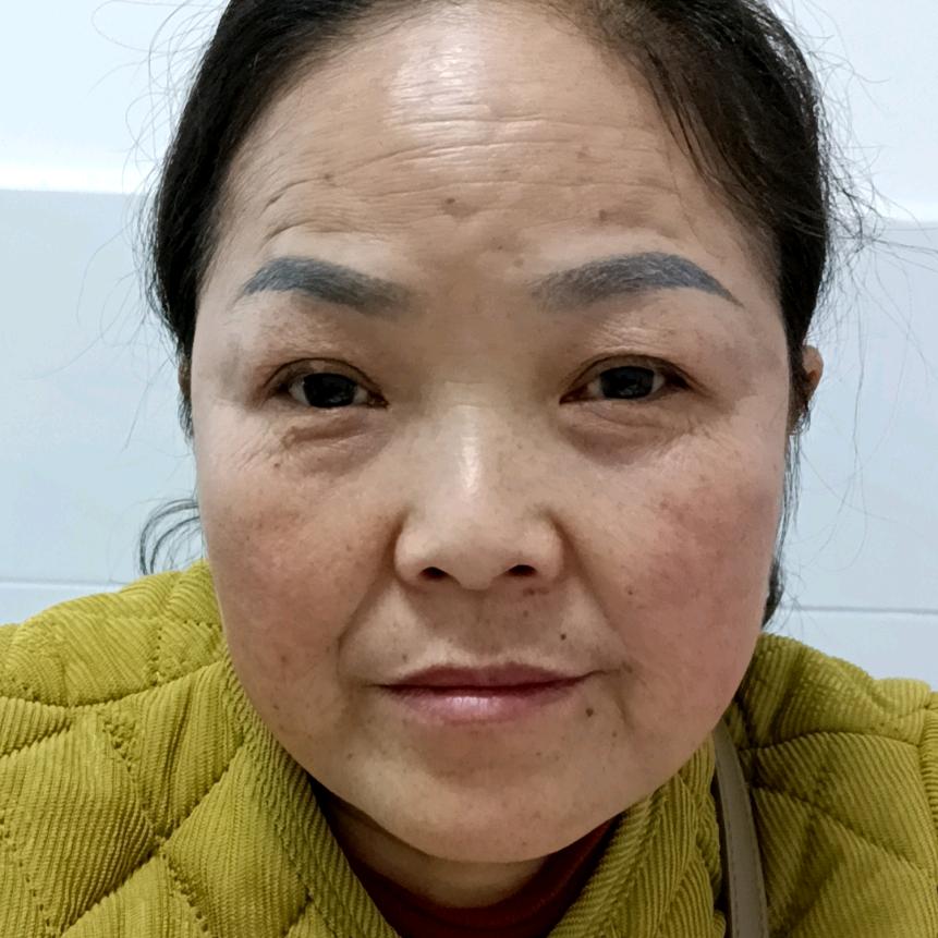 小飞平