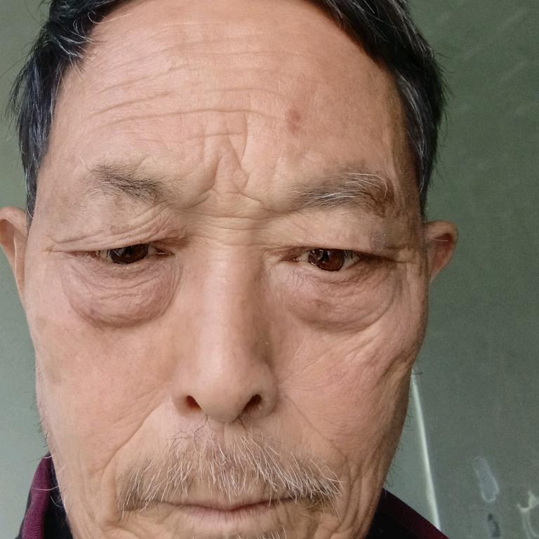 赵大光