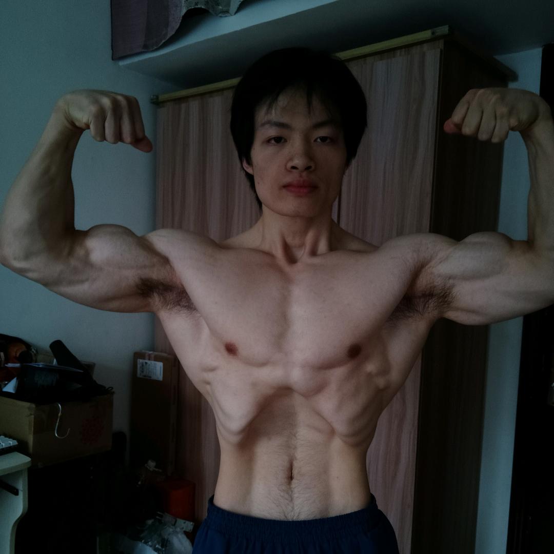 肌无力（接线上线下）