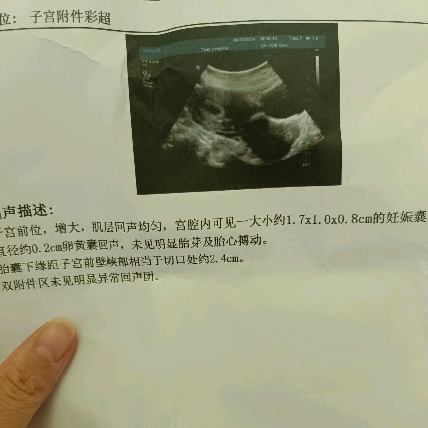 🍓盼儿（孕中期）