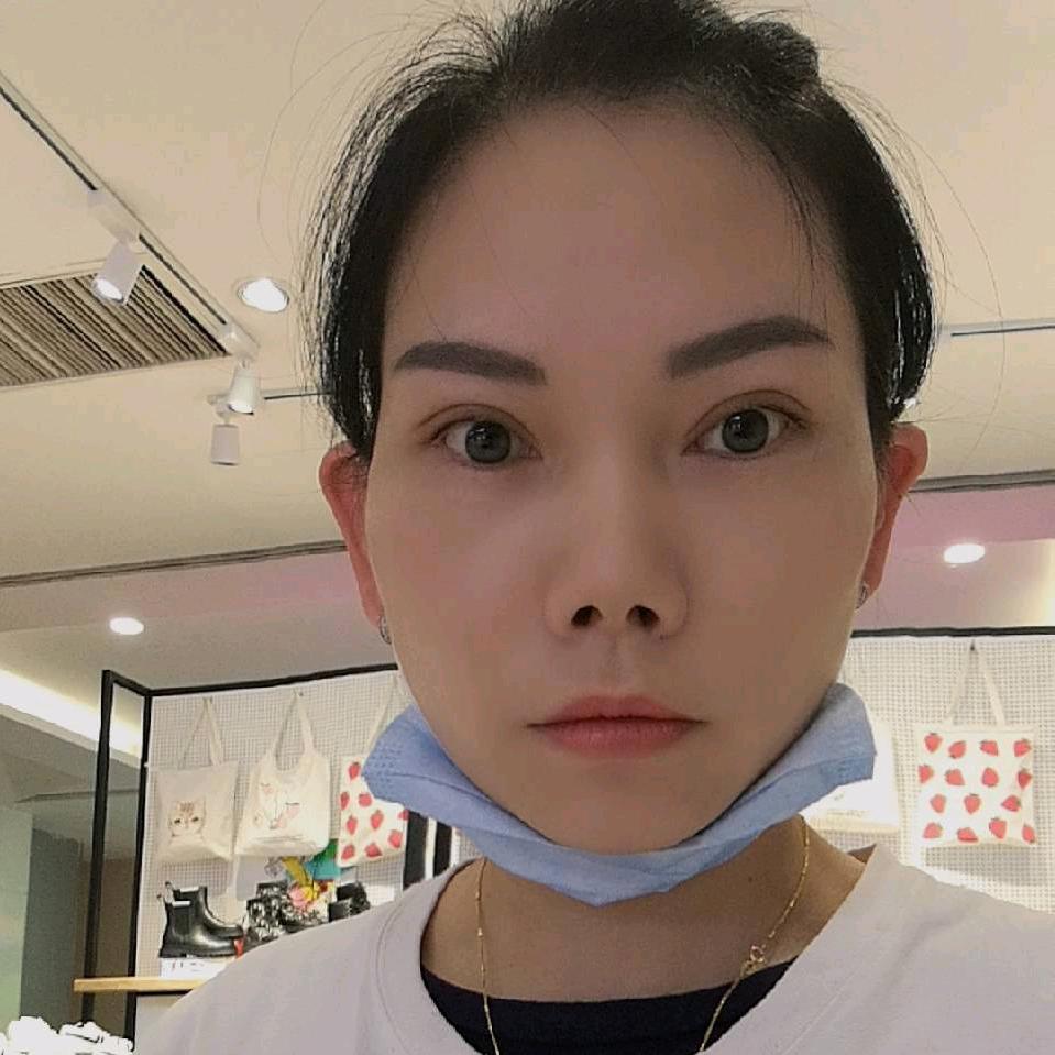 牛羊养殖～小黄