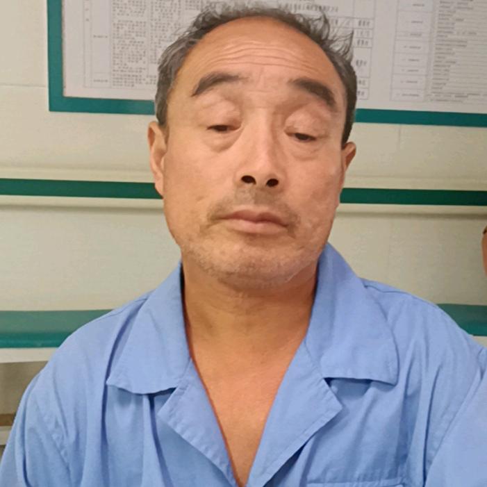 张哥