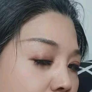 晴天