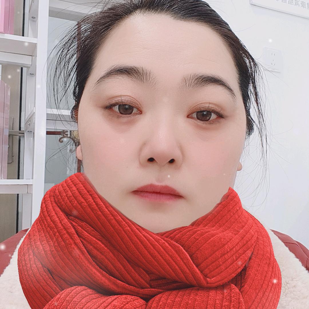 良咔瘦身店---柳梅