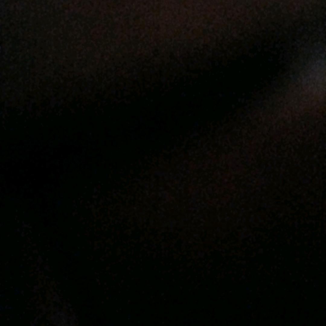 慢慢就好了应该