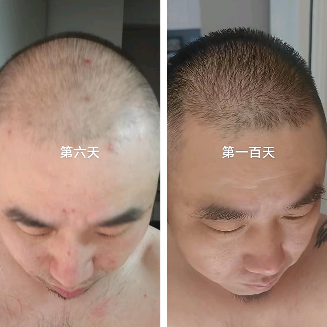 恒兄弟养发上岸