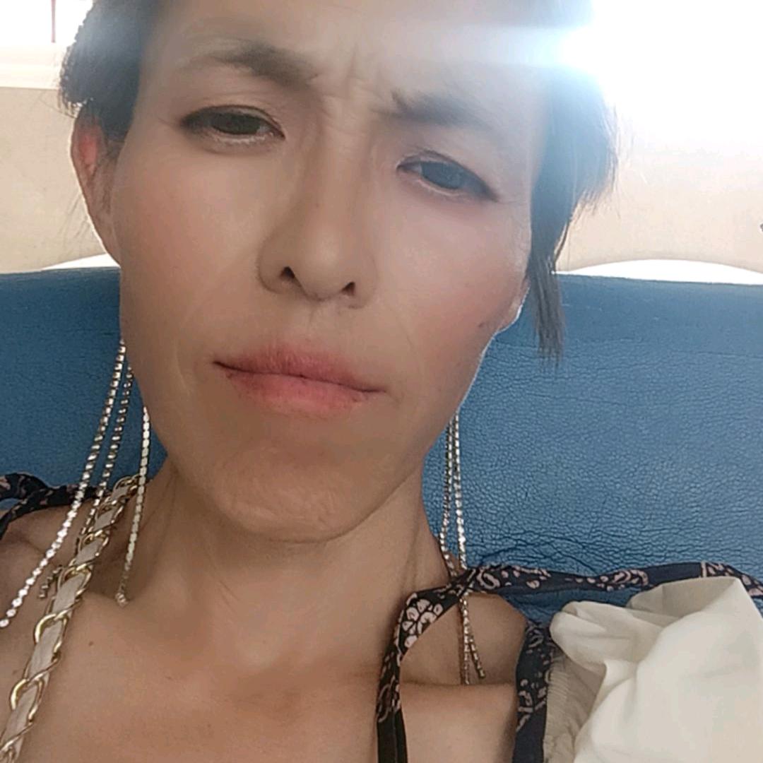 优秀网红老师残疾小儿麻痹症王文芳