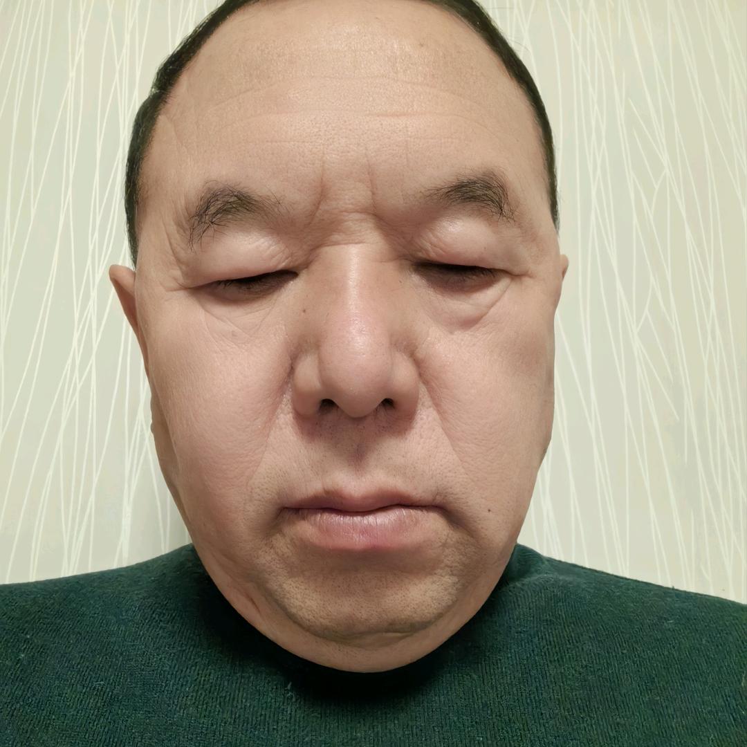 刘兰锁