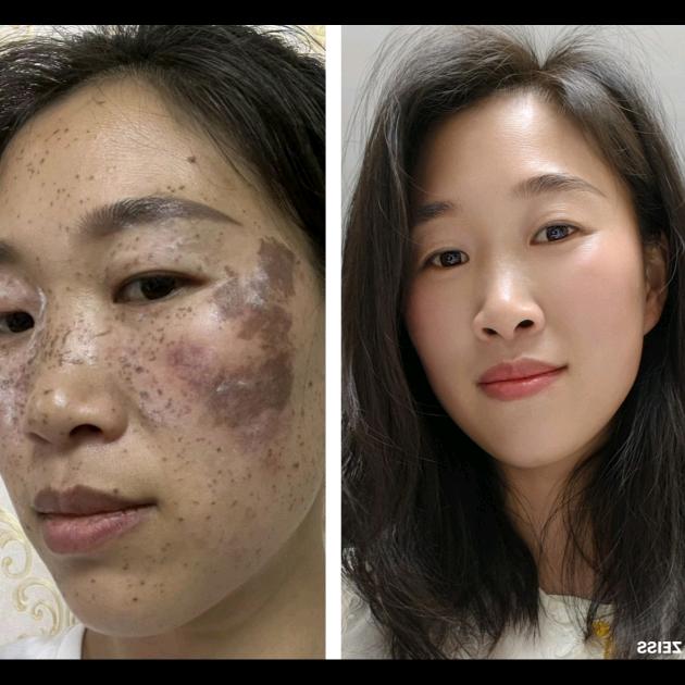 美颜美体  打造素颜脸