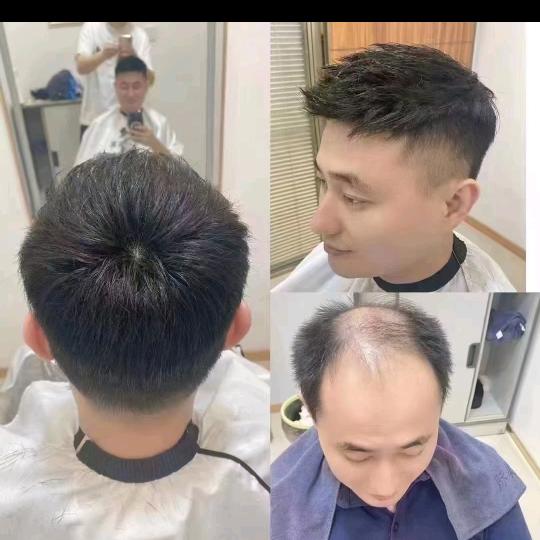 永济阿辉假发订制(收头发)