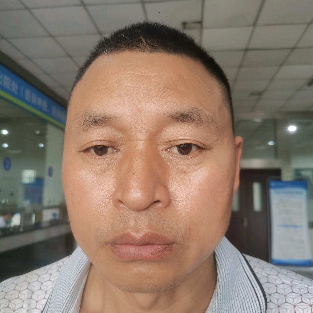 阿波