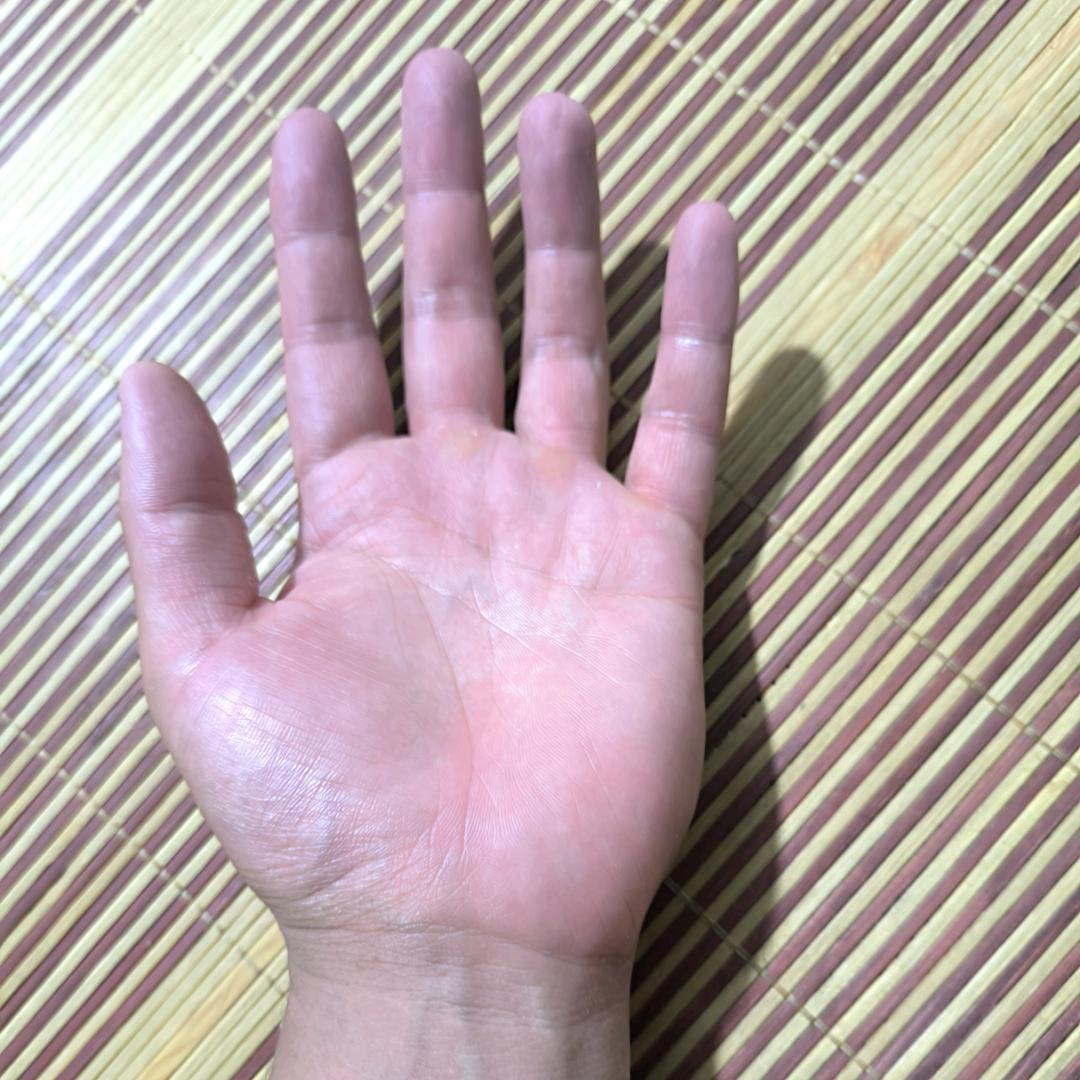 这一只黑手✋🏿