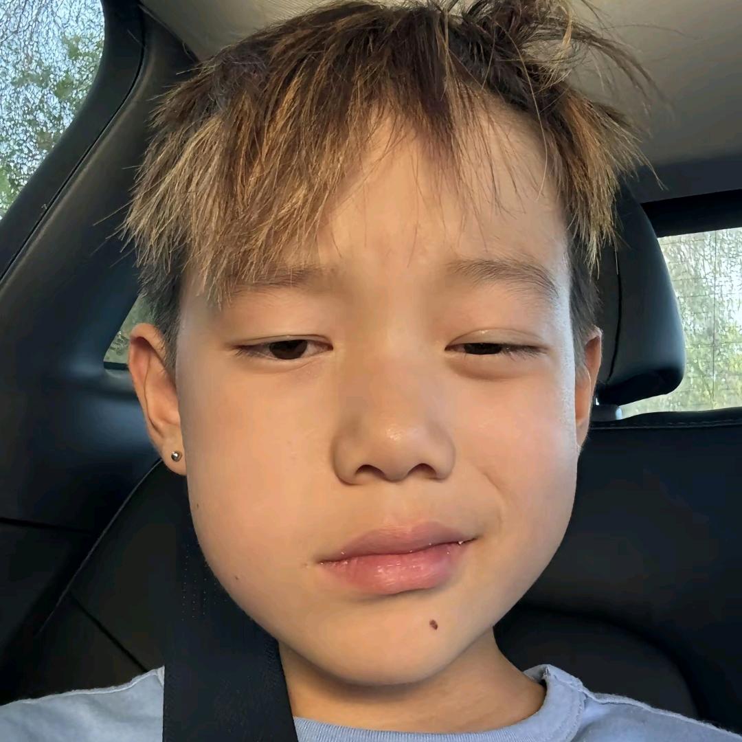 浅浅