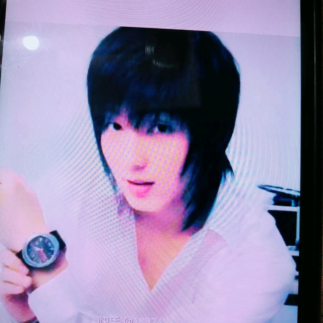 为什么受伤的总是我🐿🐍