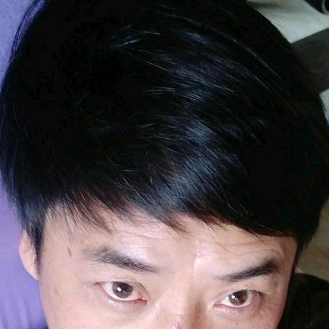 我只想满头黑发
