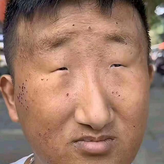 开塞露