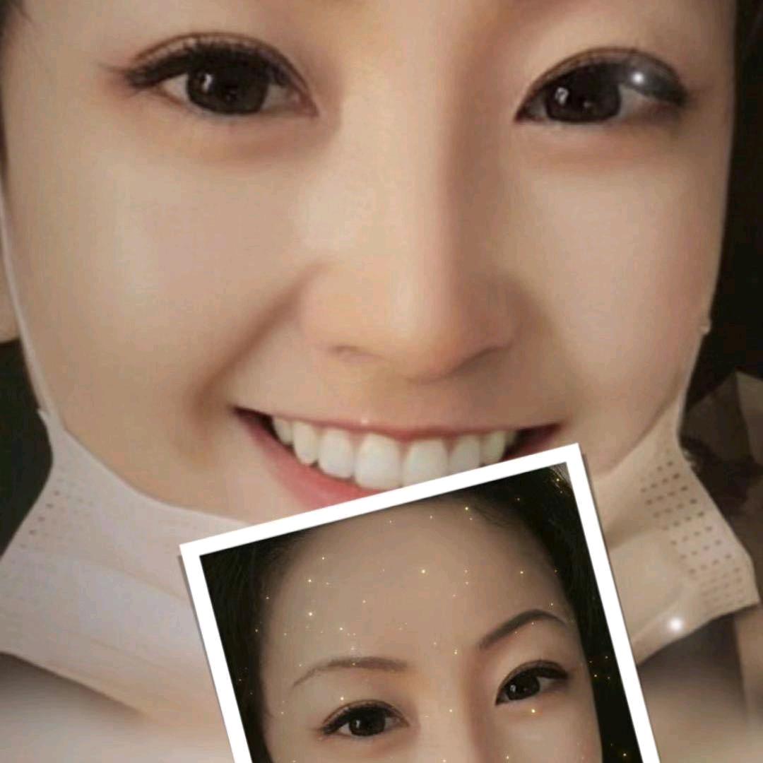 地主家的黑土豆