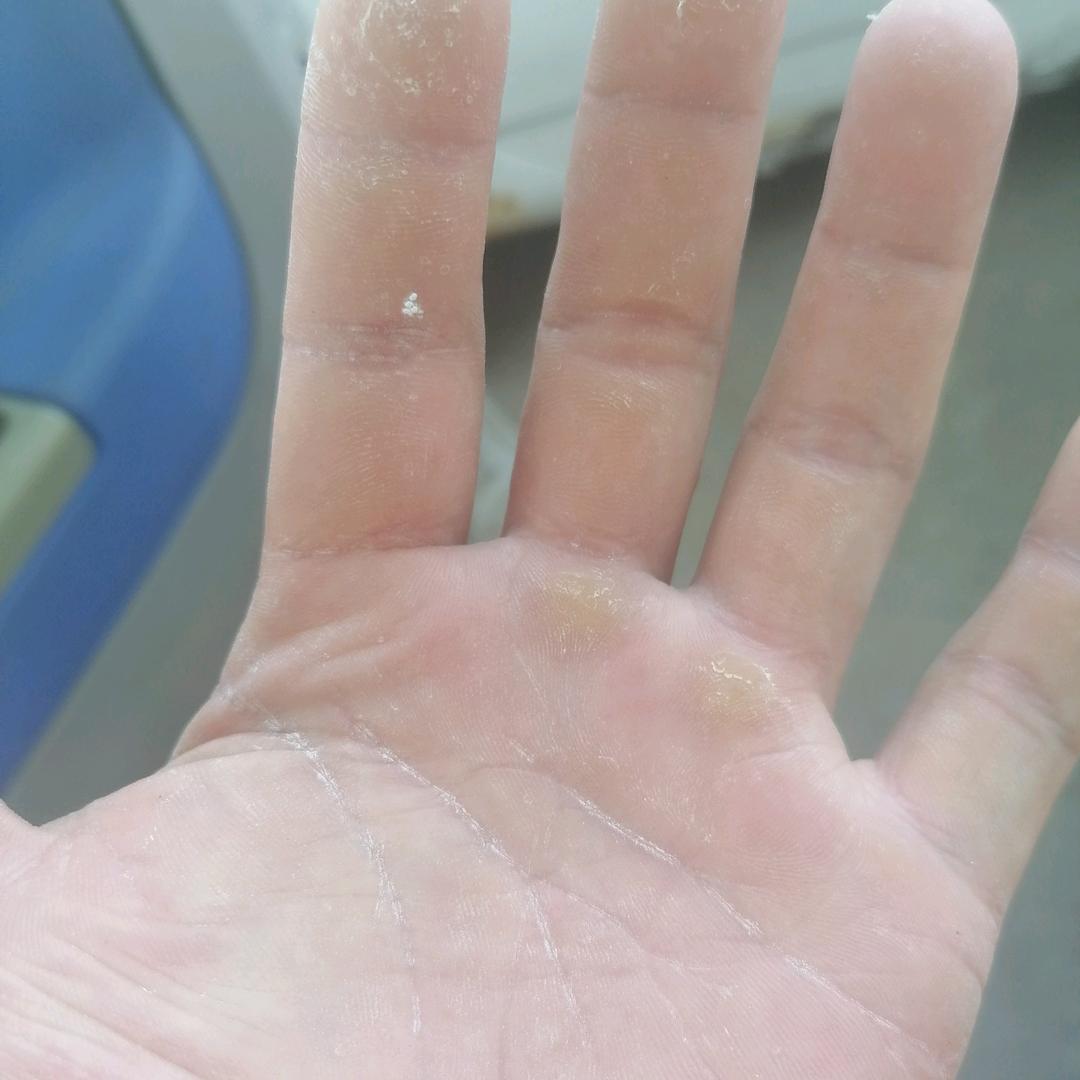 仰头，不让眼泪掉下来