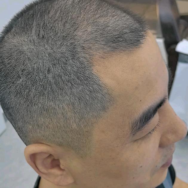 秃头开局20年