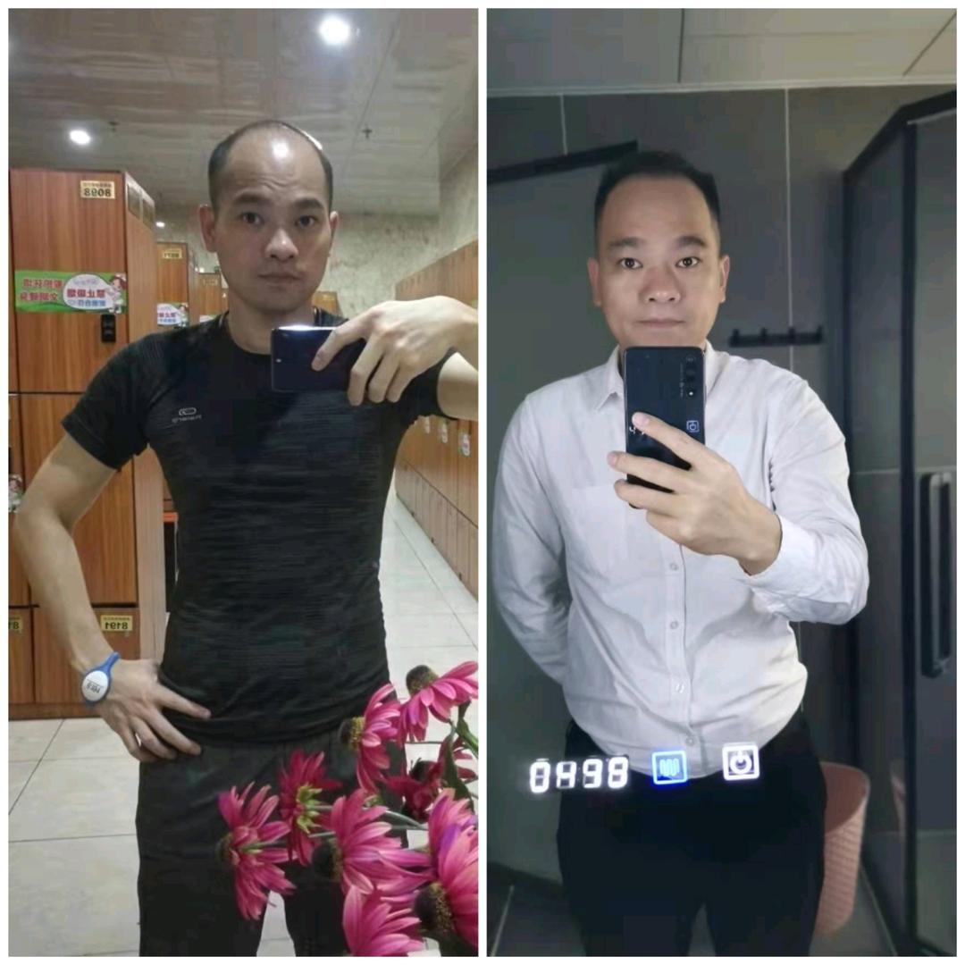 脱发老吴