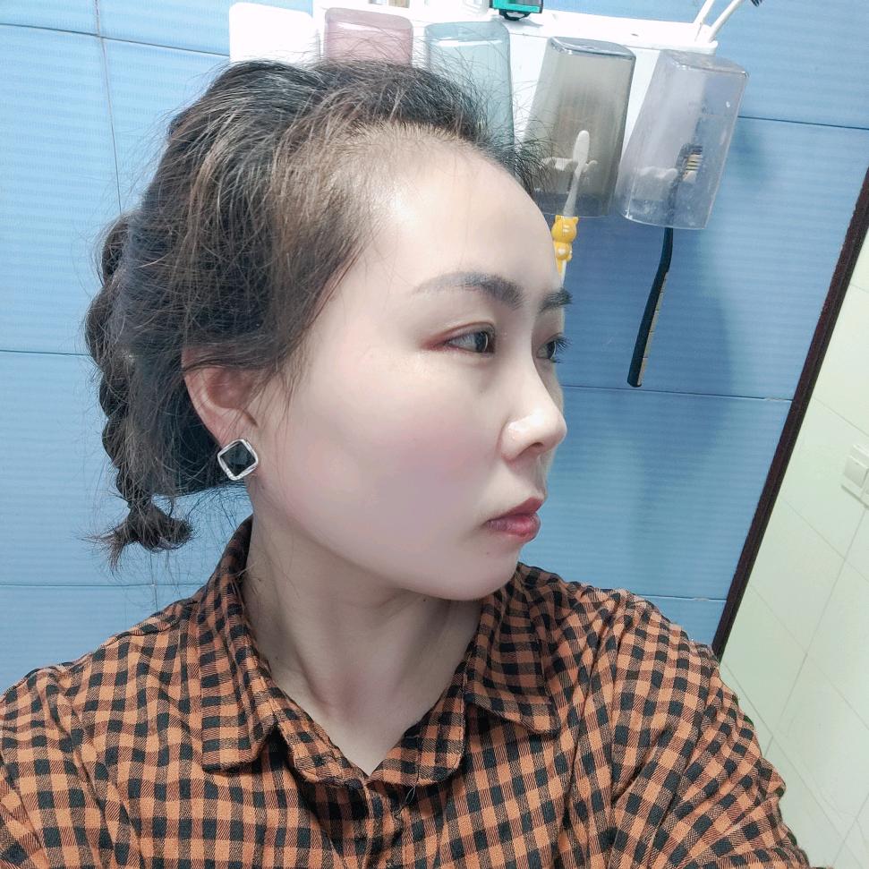 亚飞