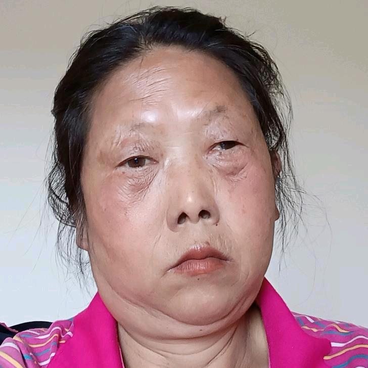 张姐