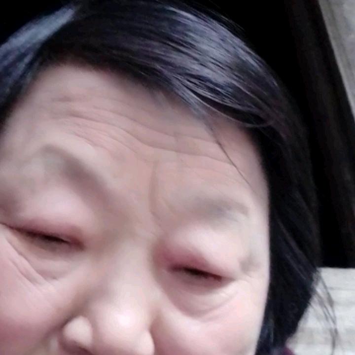 一个老年痴呆症的妈妈 😃😃😃