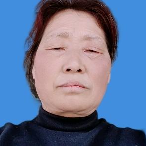 王永梅
