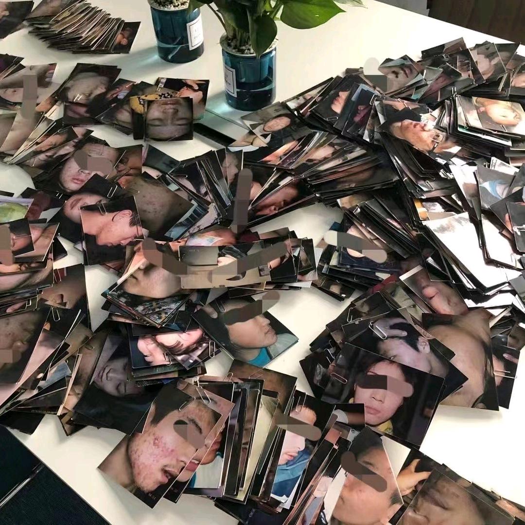 豆豆姐（邯郸）专搞顽固痘肌