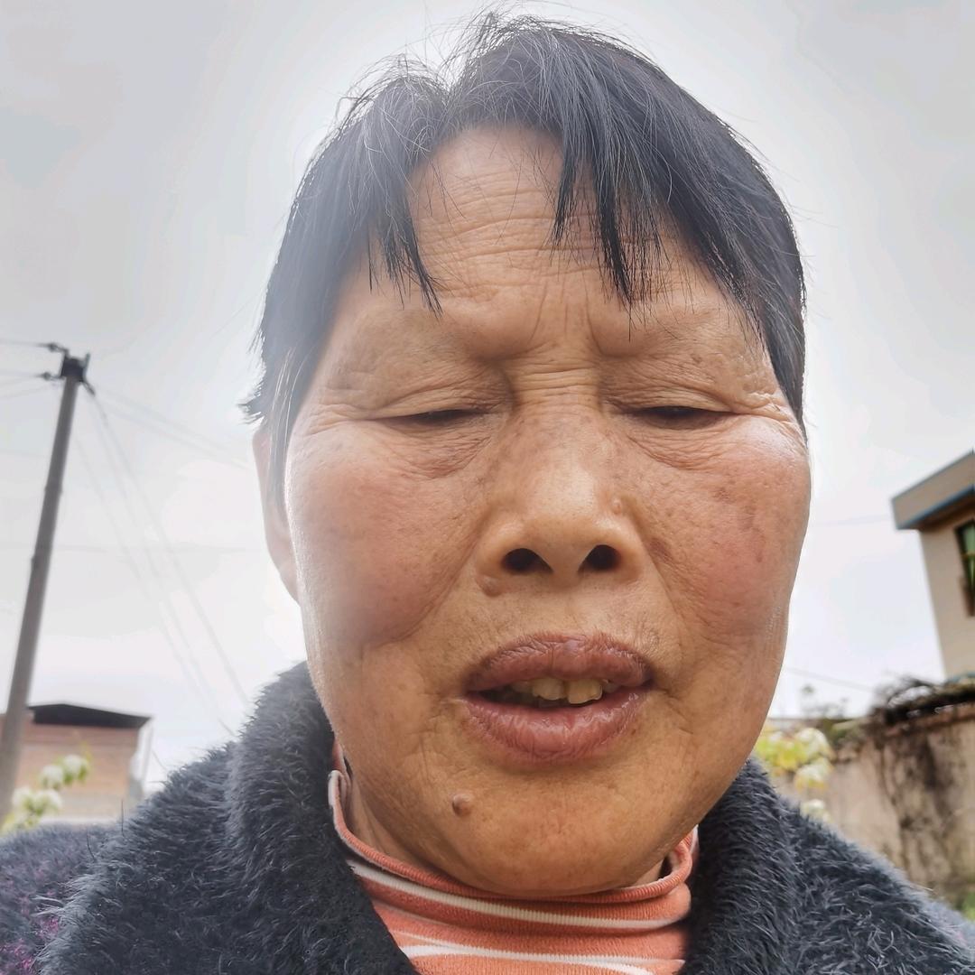 张永z