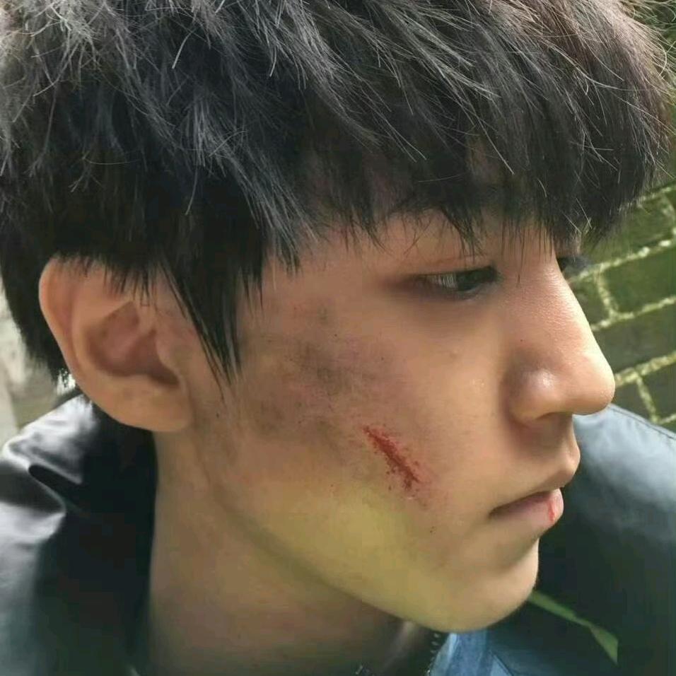 壮观的粉红痞颜