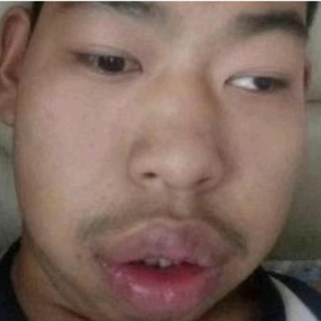 小号创口贴