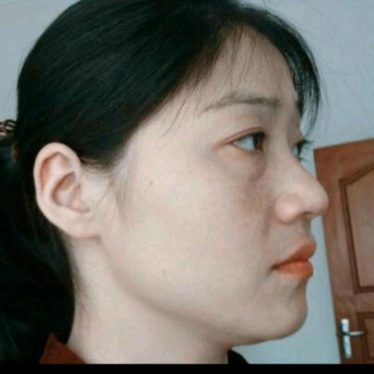 樱桃