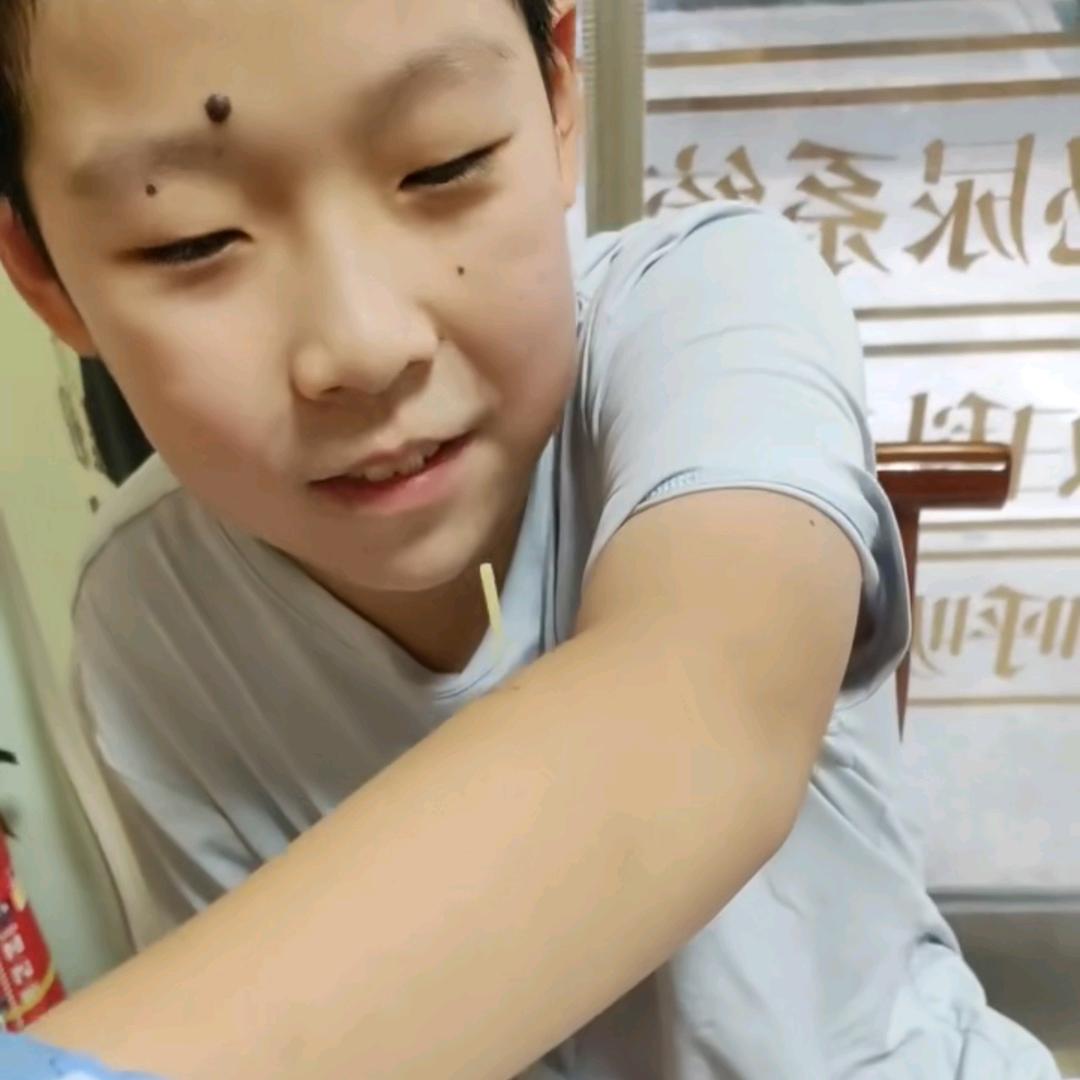 针灸小老弟