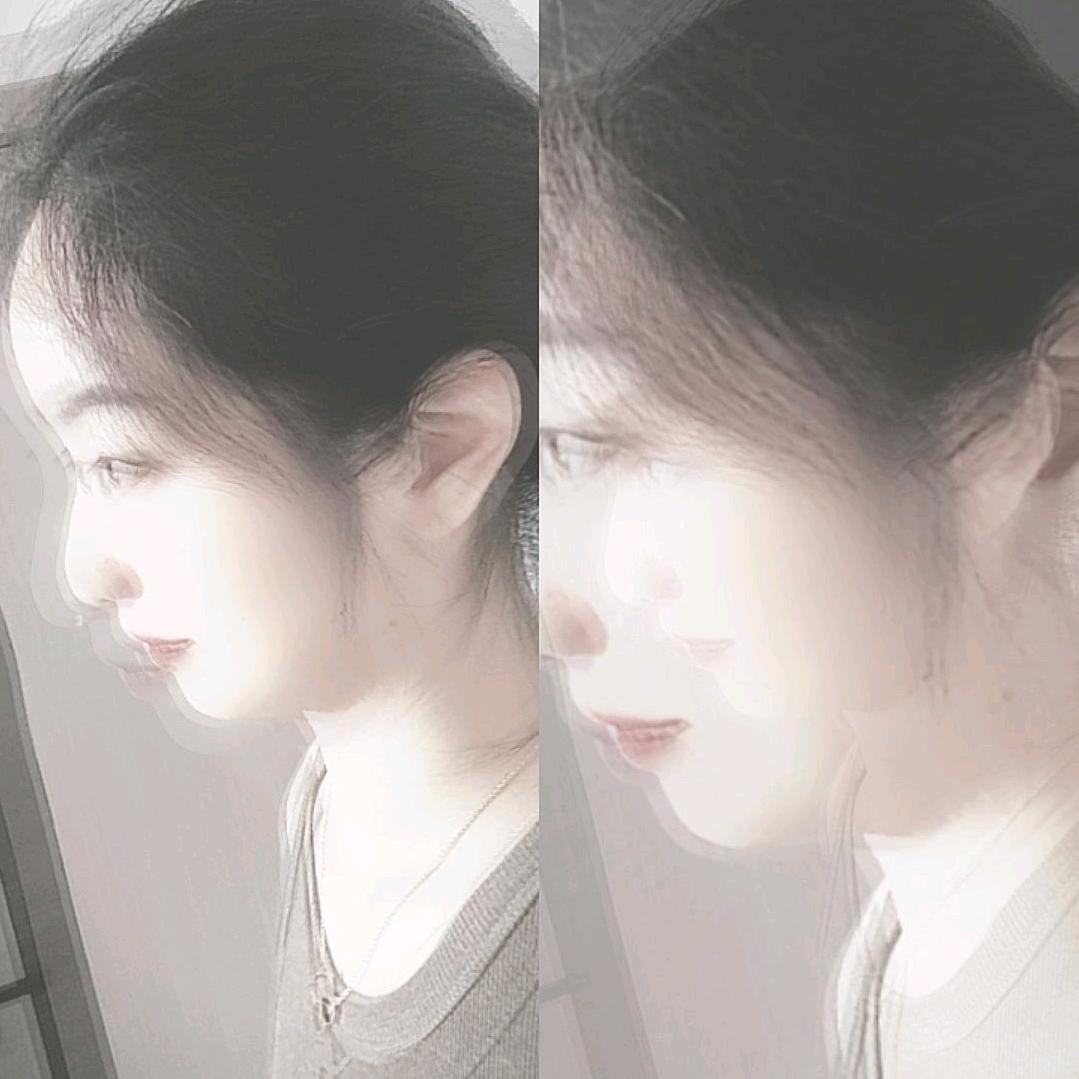 粒粒