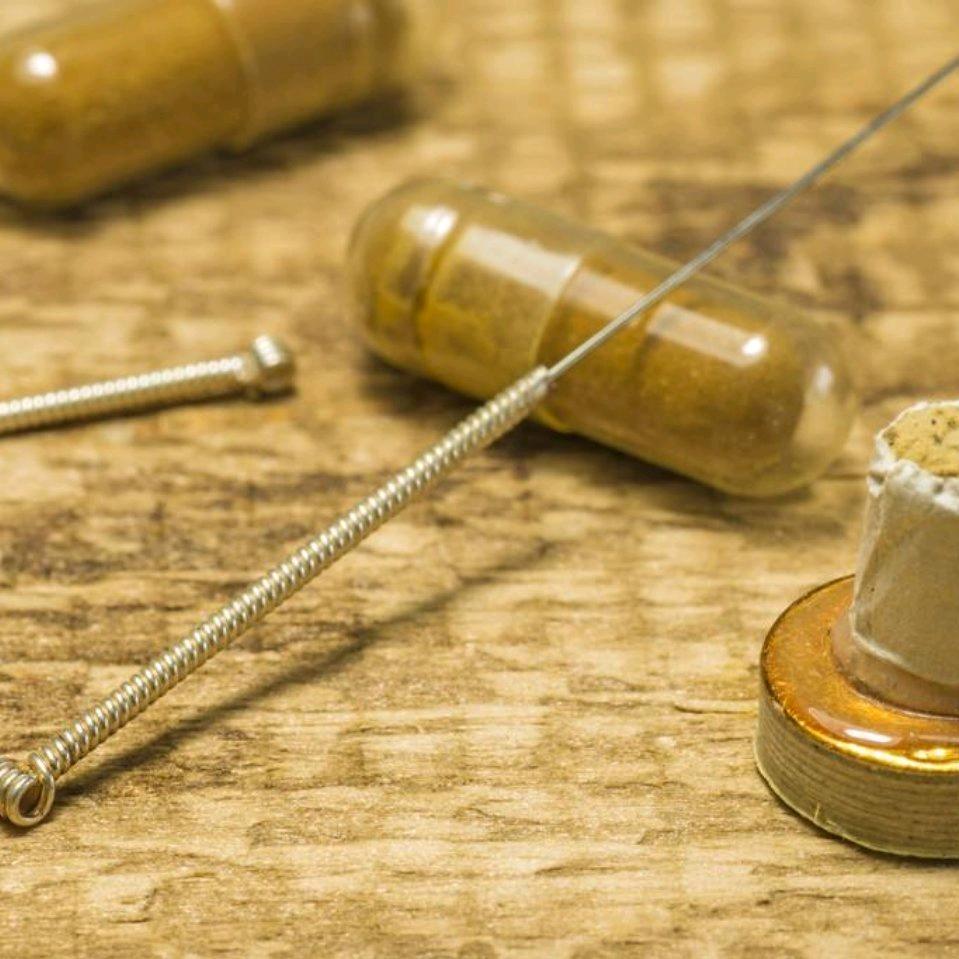 智能穿戴全国招商免费铺货