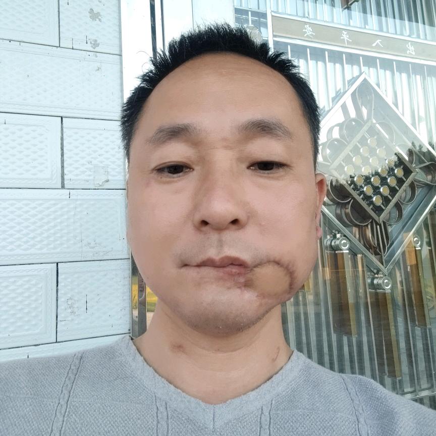 健哥重生