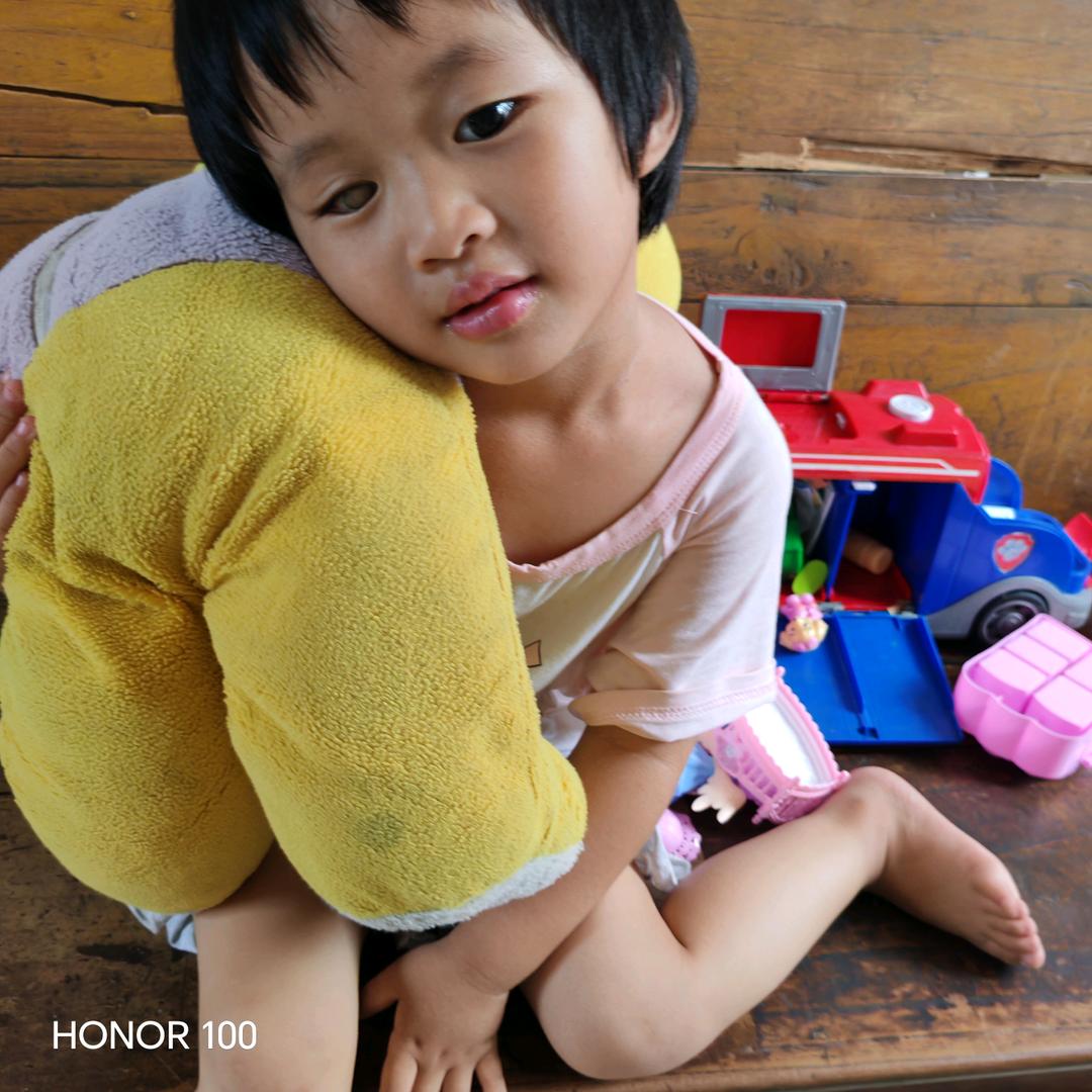 瑶儿(高度近视)