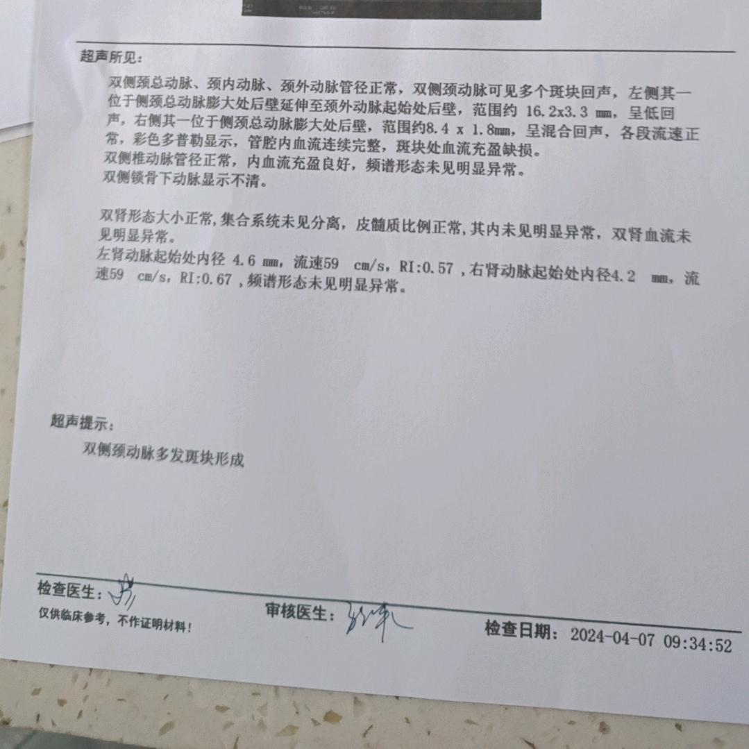 孤独灬狼