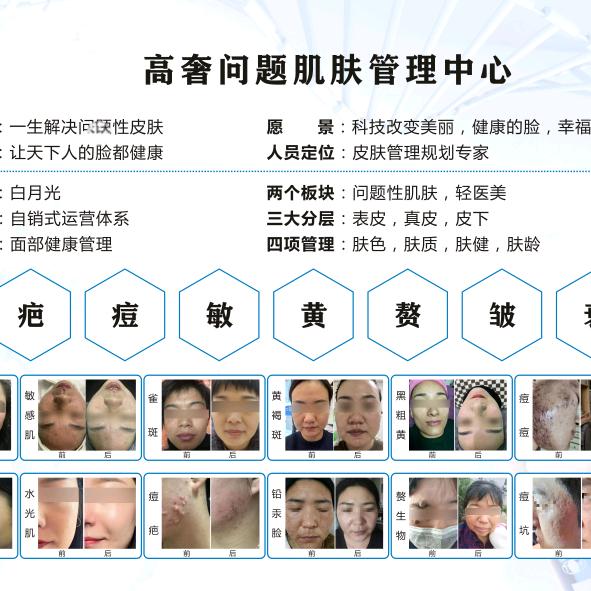 固始肌肤优化美肤中心