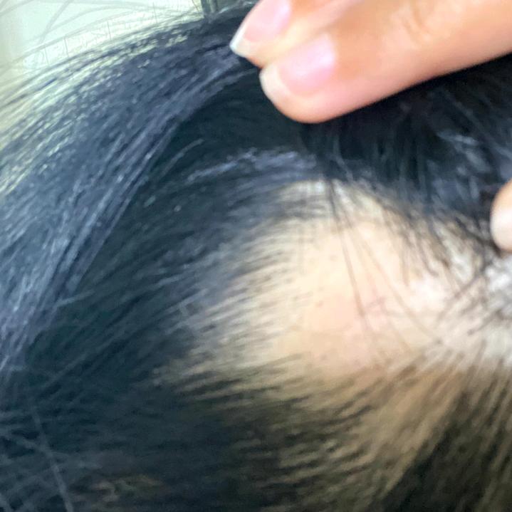 高粱生发记